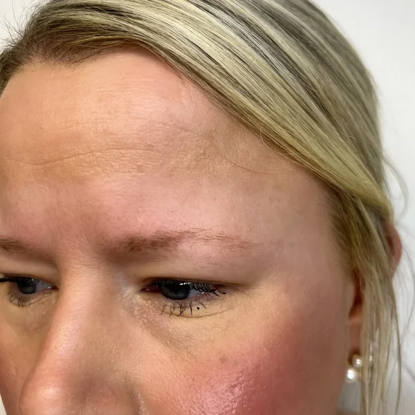 Sparse fine brunette brows before microblading by Lorraine Gold Coast