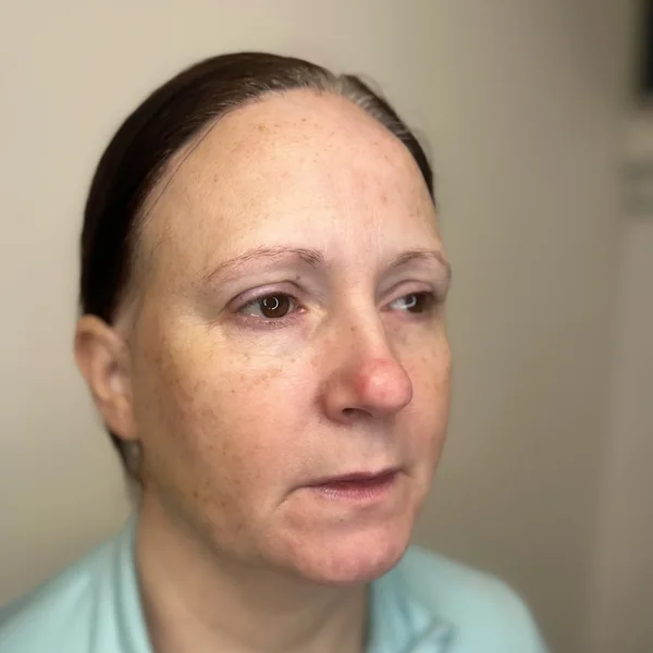 Thin faded mature brows before 3D feather brow tattoo restoration