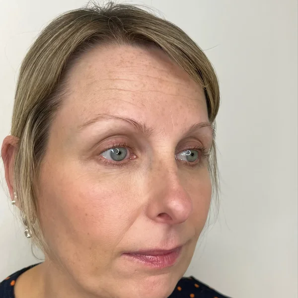 Very thin sparse blonde brows close-up before 3D feather tattoo treatment