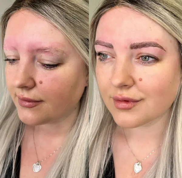 Before and after Alopecia brow restoration faded brows natural result by Lorraine, Gold Coast
