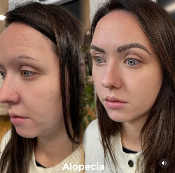 Before and after Alopecia brow tattoo sparse to full natural result by Lorraine, Gold Coast