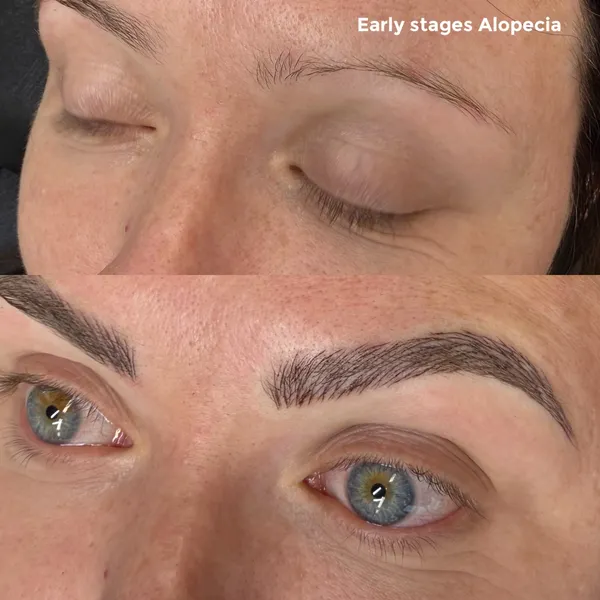 Before and after Early stage alopecia brow tattoo hair stroke result by Lorraine, Gold Coast