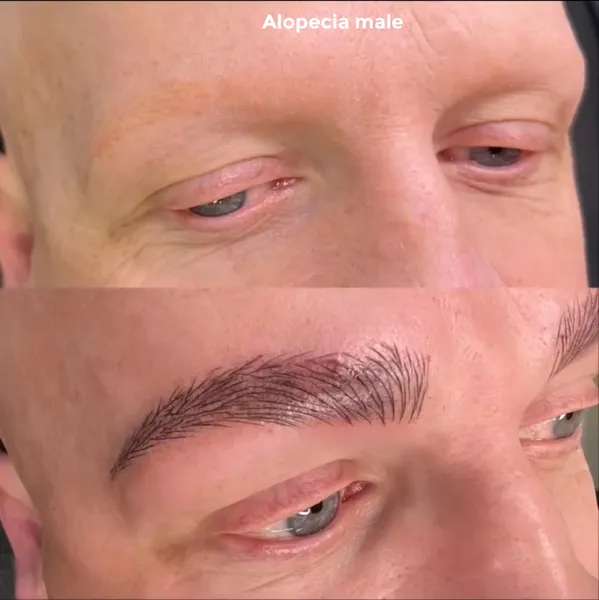 Before and after Men's alopecia brow tattoo natural hair stroke result by Lorraine, Gold Coast