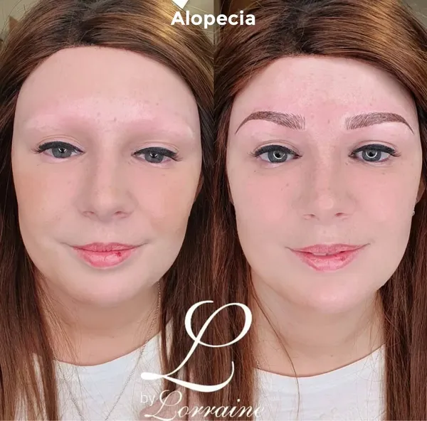 Before and after Alopecia brow recreation complete brow loss restored by Lorraine, Gold Coast