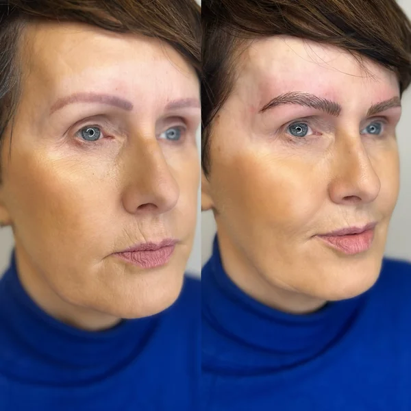 Before and after Brow tattoo mature client natural fullness restored by Lorraine, Gold Coast