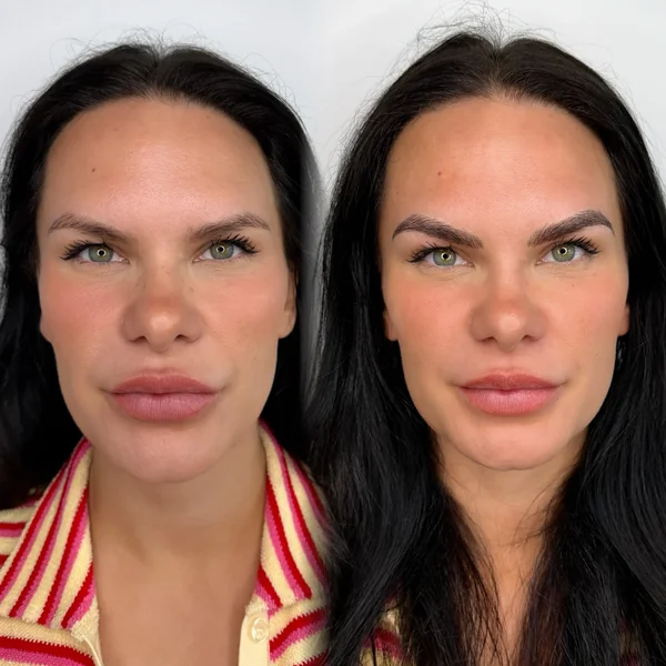 Before and after Cosmetic eyebrow tattoo brunette result by Lorraine, Gold Coast
