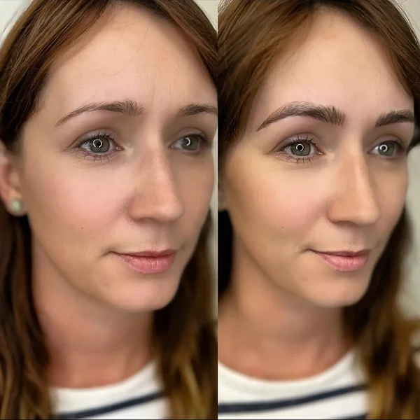 Before and after eyebrow tattoo on redhead — warm tone, sparse to defined