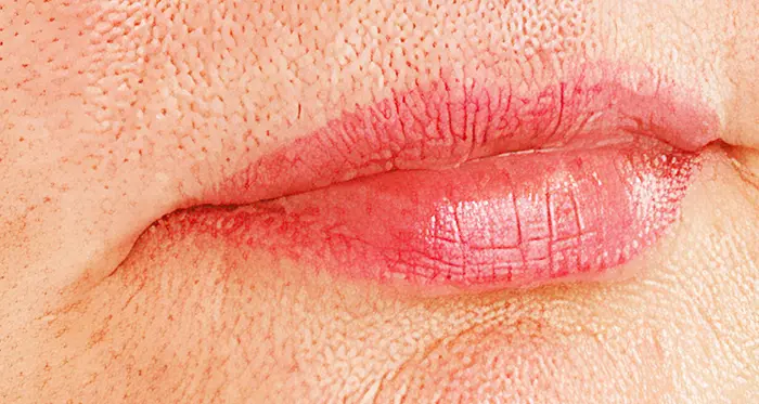 Before — Lip blush before and after — natural lips restored with bespoke pigment by Lorraine, Gold Coast