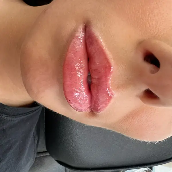 Lip blush before and after — deep berry healed result close-up
